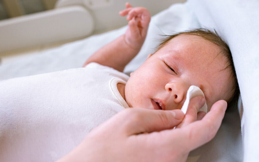 درمانهای خانگی انسداد مجرای اشک نوزادان