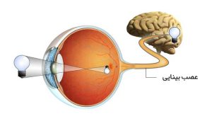 آسیب عصب بینایی و علائم ناشی از آن