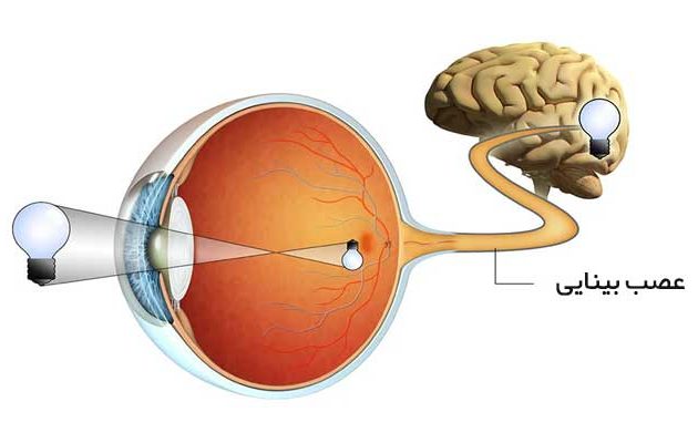 آسیب عصب بینایی و علائم ناشی از آن